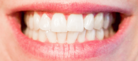 Dental Clinic in Sector 76 Noida