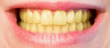 Dentist in Sector 76 Noida