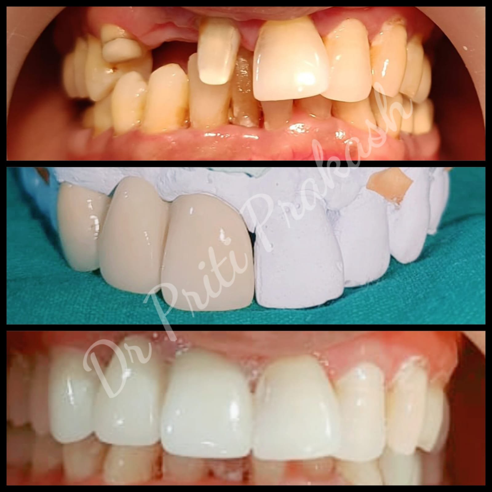Best Dentist in Noida