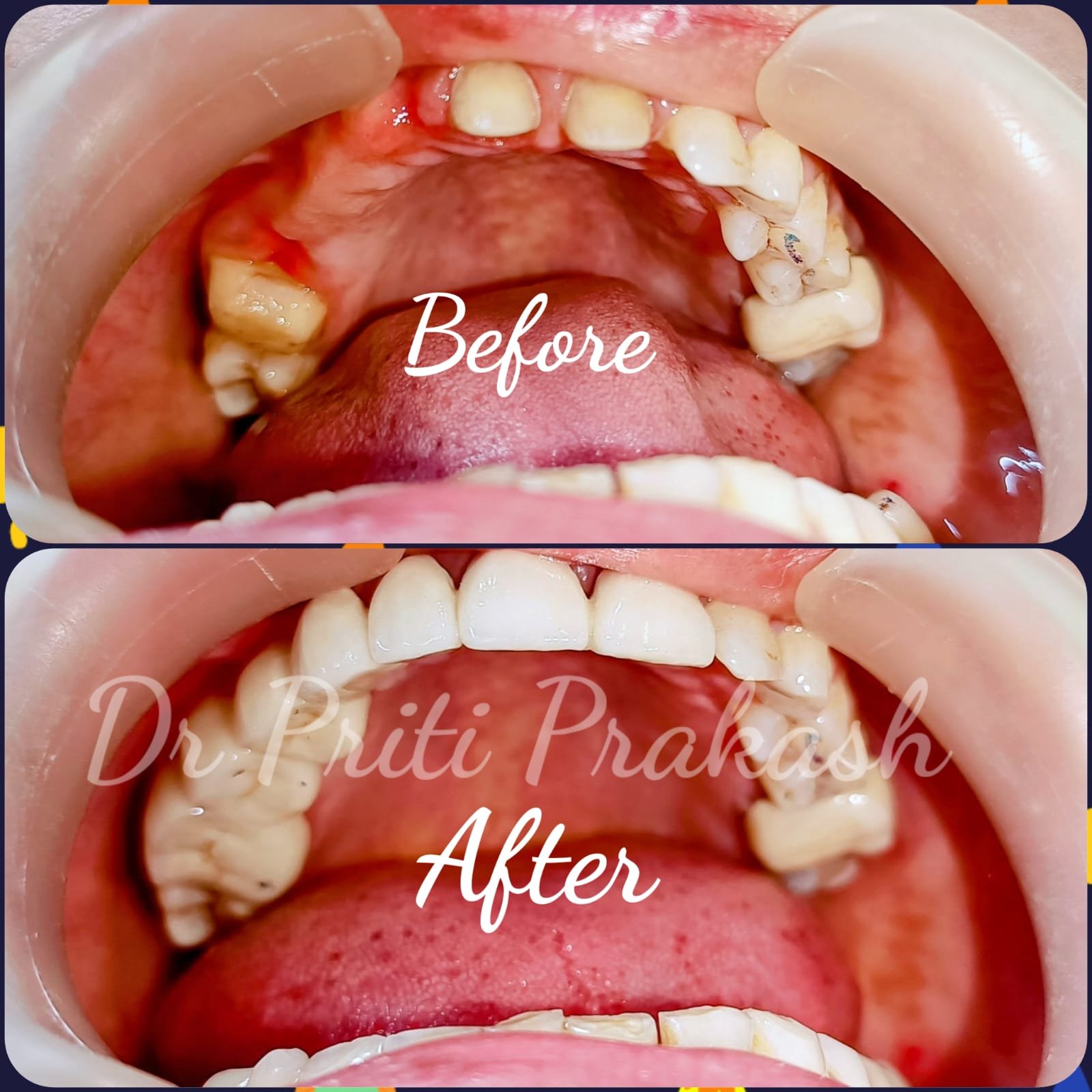 Dental Clinic in Noida