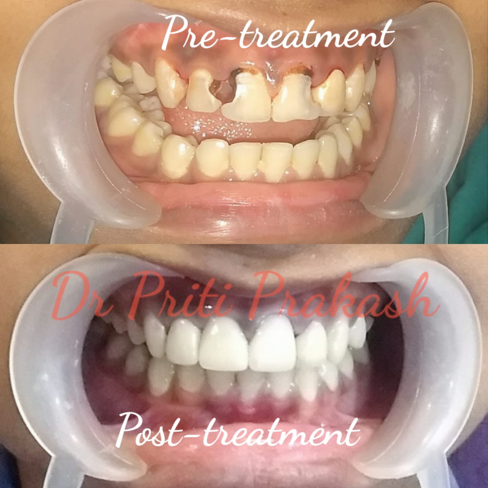 Dental Clinic in Sector 78 Noida