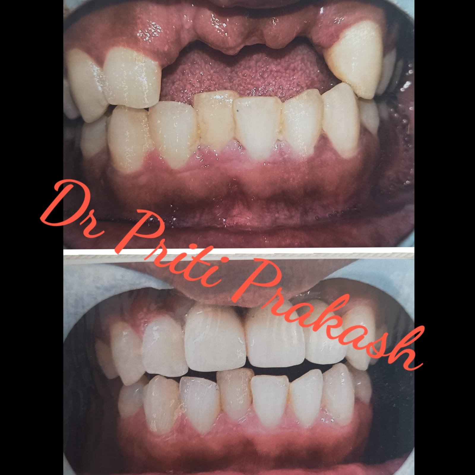 Dental Clinic in Noida