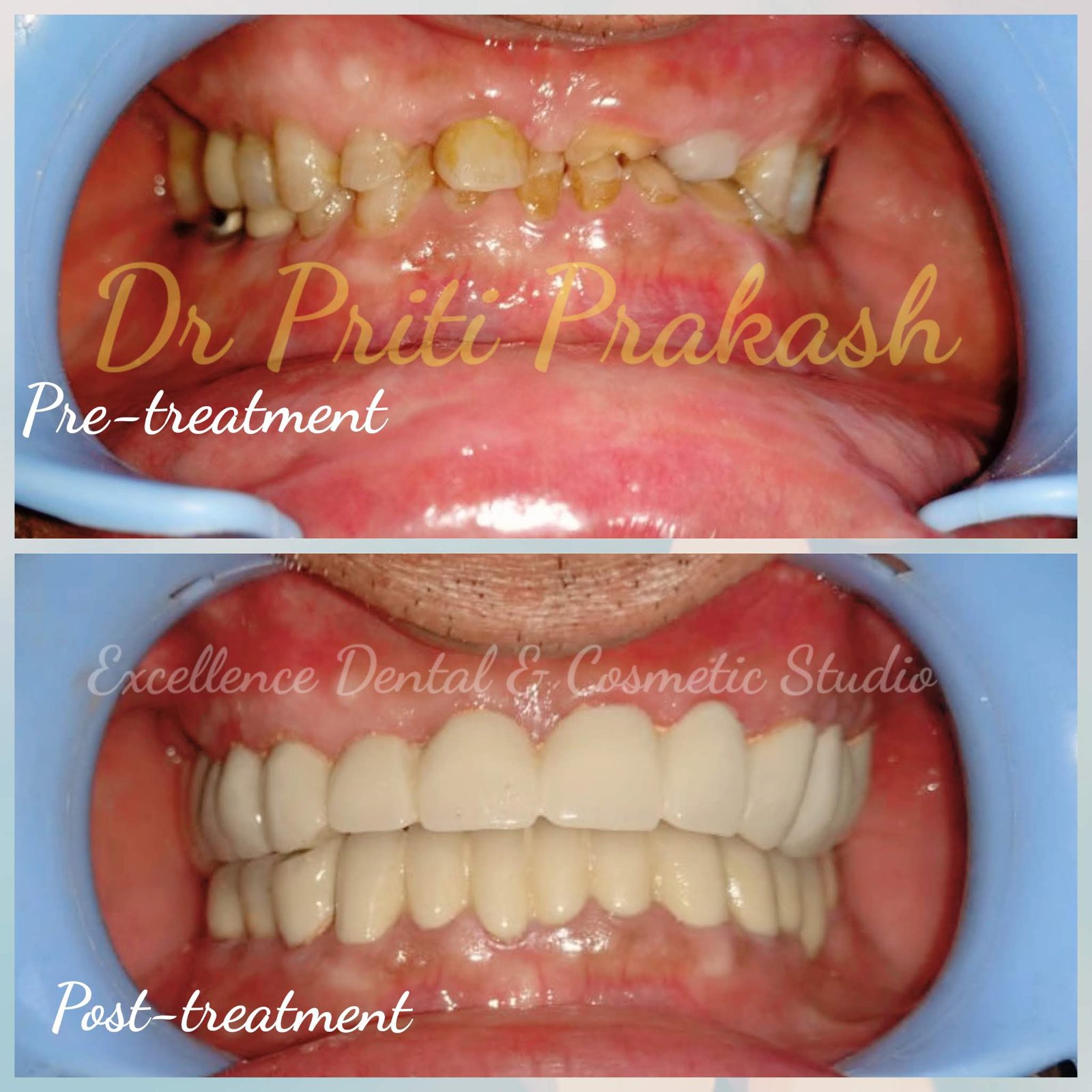 Dentist in Sector 78 Noida