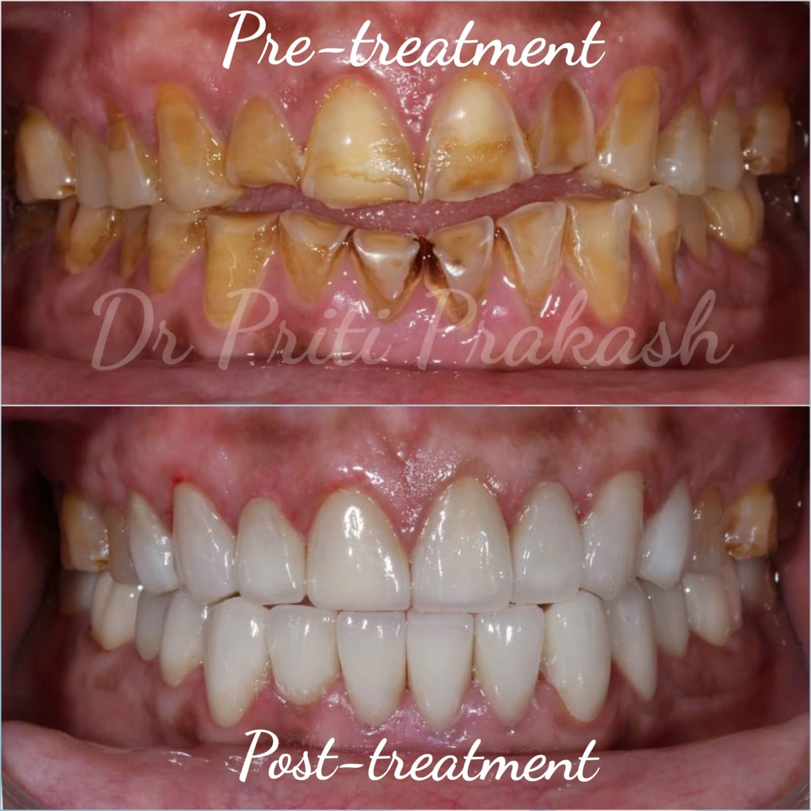 Dentist in Sector 78 Noida